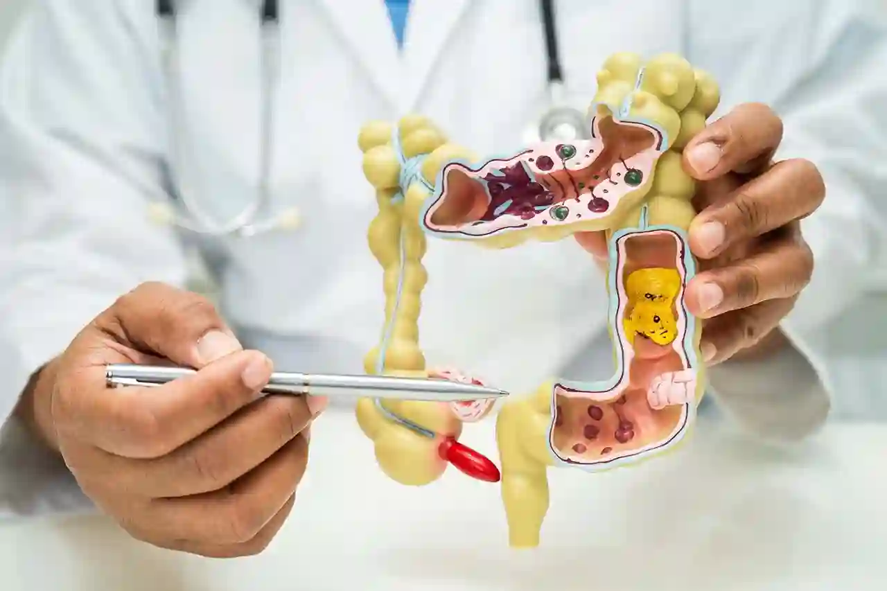 Polyp