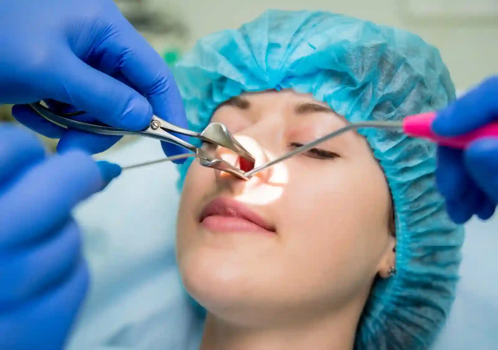 Sinus Surgery