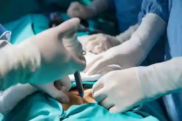 Thyroid Surgery