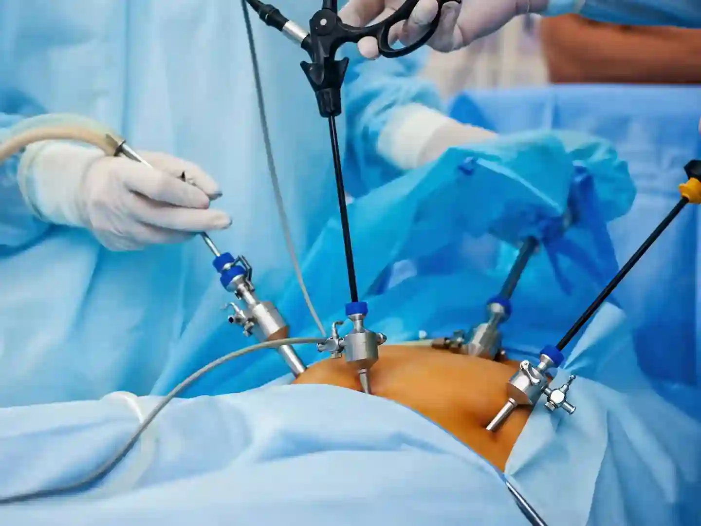 Surgery