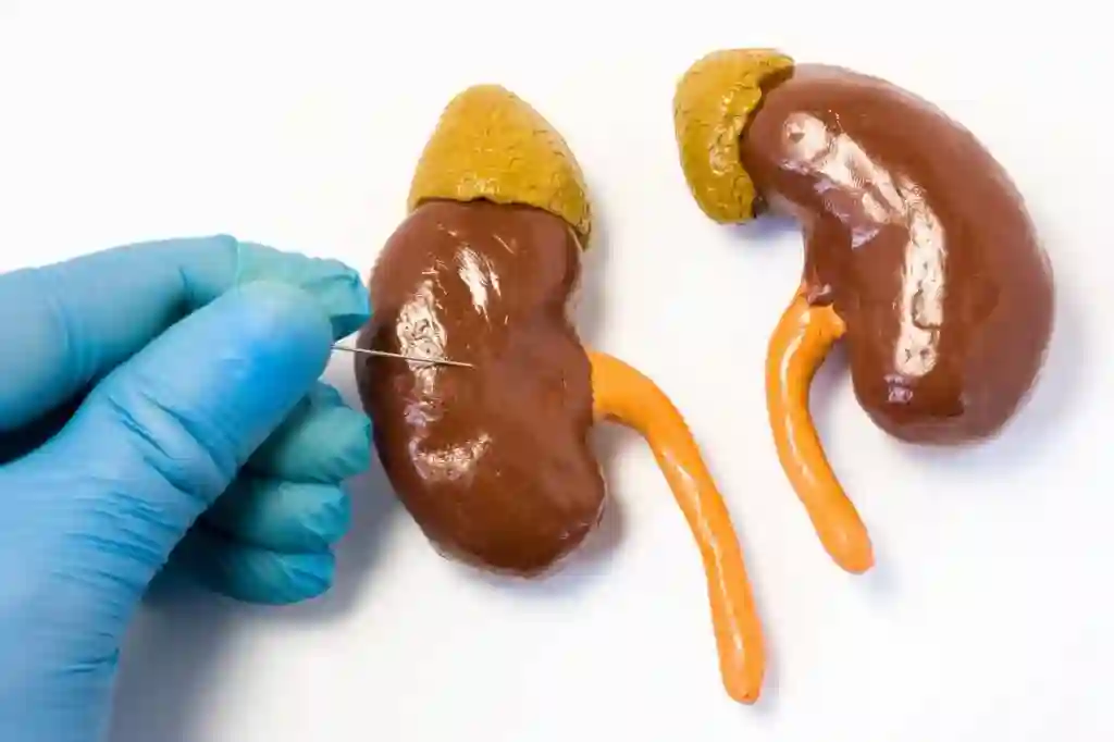 Critical Care Nephrology